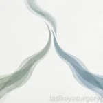 Alternatives to LASIK PRK explained — featured image